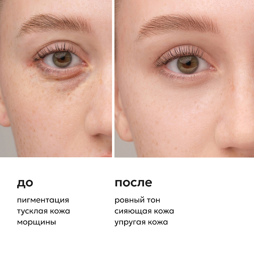LIKATO Питательная сыворотка вокруг глаз с витамином С 7% Vitamin C Eye Serum – фото 4