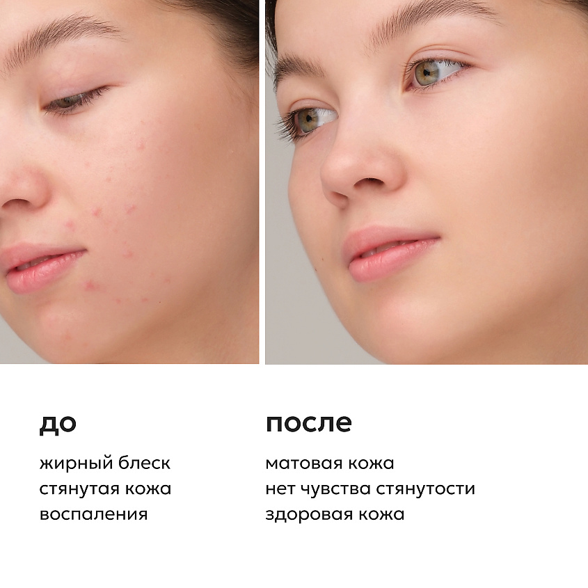LIKATO Очищающий гель для умывания с АНА-кислотами Acids Facial Cleansing Gel – фото 4