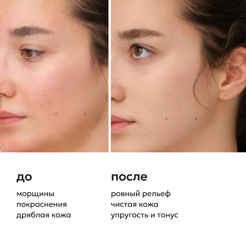 LIKATO Многофункциональная сыворотка-концентрат 5 в 1 Multi Serum Cross Control – фото 4