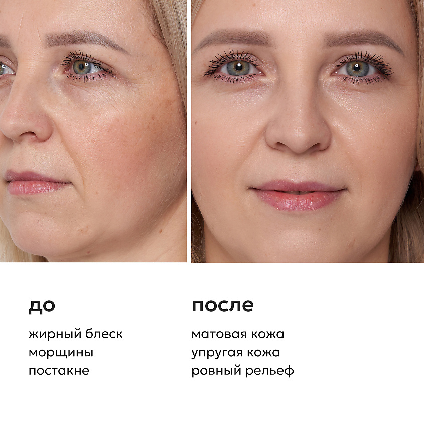 LIKATO Отшелушивающая сыворотка-концентрат с молочной кислотой 5% Lactic Acid Serum – фото 4